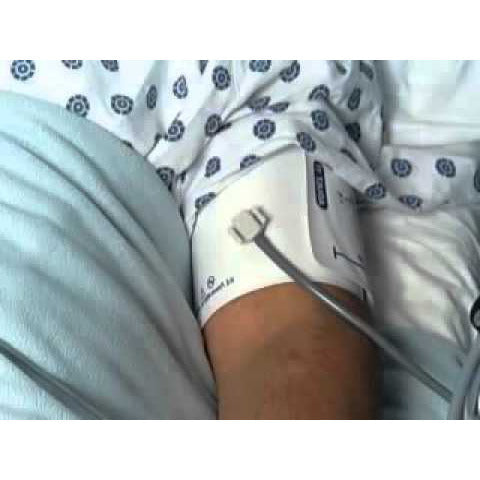 Welch Allyn Flexiport Adult Cuff size 11L Inflation System (25-34cm)